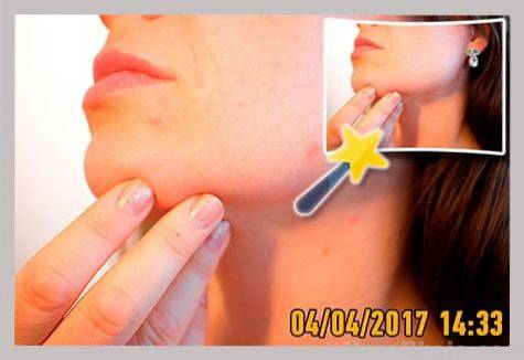 13 Cel mai bun software pentru eliminarea filigranului