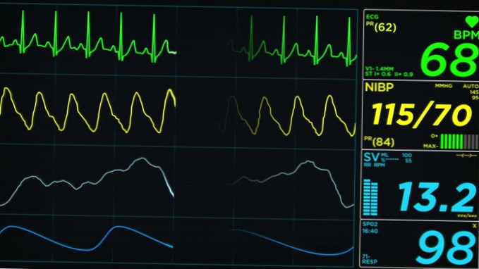 cum arată o frecvență cardiacă normală pe un monitor
