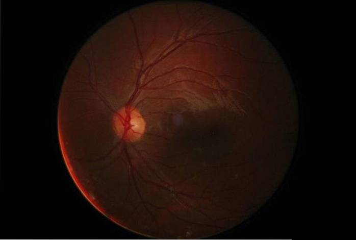 Hjärtsjukdom kan bestämmas av Google Algorithm